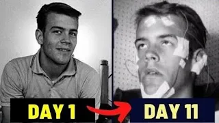 He didn't Sleep for 11 Days, and this is what Happend to him😰😰