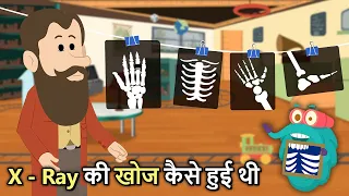 X - Ray का आविष्कार कैसे हुआ | Invention Of X Ray In Hindi | Binocs Ki Duniya