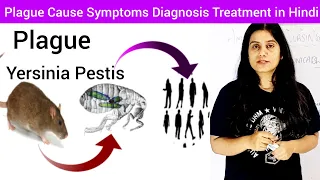 Plague Cause Symptoms Diagnosis Treatment in Hindi | What is Plague | Yersinia Pestis | Plague Hindi