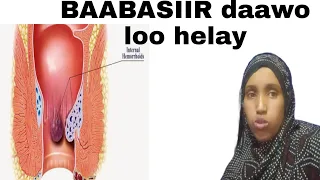 BAABASIIR HADOW KU DHIBAY DAAWADIISA WAA TANAA  DEG DEG  ISKU DAAWEY