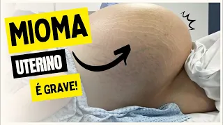 Mioma no útero é grave