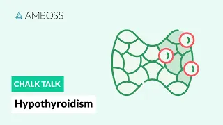 Hypothyroidism: A Diagnostic Approach