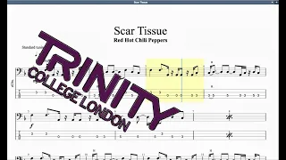 Scar Tissue Trinity Grade 6 Bass