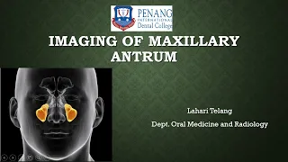 Imaging of Maxillary Antrum