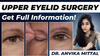 Everything You Need to Know About Upper Eyelid Surgery | Dr. Anvika Explains