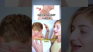 Neck hump hack | Face Fitness, Facial Fitness, Facial Yoga