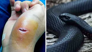 20 Most Venomous Snakes in the World You Wont Believe Actually Exist