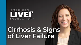 Progression of Liver Disease Webcast Series: Cirrhosis and Signs of Liver Failure