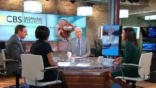 Morning Rounds: Opioid prescriptions, treating back pain, and more