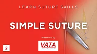 Simple Suture - Learn Suture Techniques - VATA