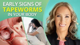 Don’t Ignore These Early Signs of #Tapeworms in Your Body | Dr. J9 Live