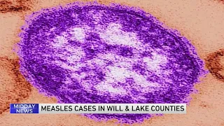 Will County reports positive case of measles, connected to Chicago outbreak