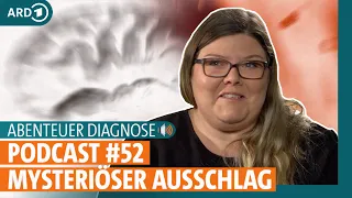 Abenteuer Diagnose Podcast #52: Arbeitsallergie - Fieber und unheimliche Hautausschläge | ARD GESUND
