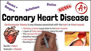 CORONARY HEART DISEASE - Biology GCSE and iGCSE Revision