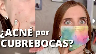 CÓMO EVITAR EL ACNÉ POR EL CUBREBOCAS: YO TE AYUDO!!