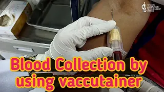 Blood collection by using vaccutainer method.closed system of blood collection.