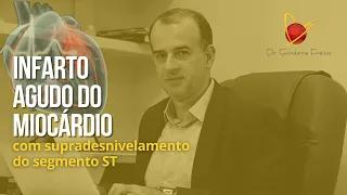 Infarto Agudo do Miocárdio com supradesnivelamento do segmento ST | Dr. Giordanne Freitas