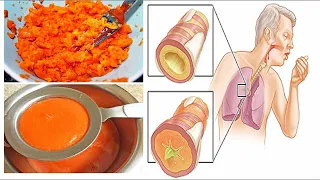 Simple Homemade Cough Syrup Removes Phlegm From The Lungs