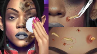 ASMR Removing Maggot Worm from Infected Face | ASMR Animation Treatment | Severely Injured Animation