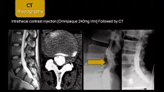 Dr  Mamdouh Mahfouz Spinal imaging normal anatomy