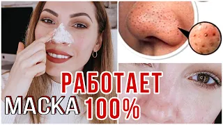 МАСКА ОТ ЧЕРНЫХ ТОЧЕК ♦️РАБОТАЕТ 100% ♦️КАК ИЗБАВИТЬСЯ ОТ ЧЕРНЫХ ТОЧЕК