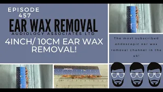 4 INCH/10CM EAR WAX REMOVAL - EP 457