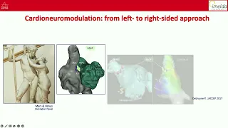 PR2023, MARCH 21 - Cardioneuroablation