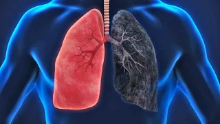 Cum ne îmbolnăveşte fumatul şi care sunt consecinţele pe termen lung