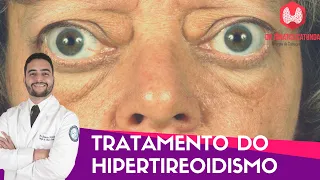 Tratamento do Hipertireoidismo