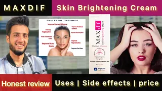 MAXDIF (Skin Brightening Cream) | Uses | Side effects | Price | HONEST REVIEW