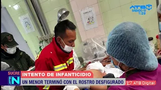 Un menor terminó con el rostro desfigurado