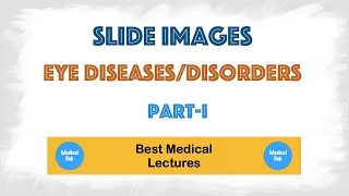 Eye diseases and disorders - Symptoms and treatments || Image based discussion|| Part-1