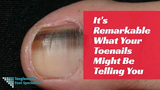 It's Remarkable What Your Toenails Might Be Telling You