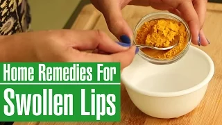 How To Get Rid Of A SWOLLEN LIPS Fast With Home Remedies