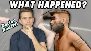 Doctor Reacts to Jeremy Stephens EYE INJURY at UFC Fight Night 159