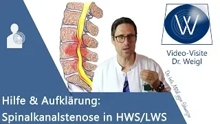 Spinalkanalstenose: Rückenschmerzen durch Spinalstenose in HWS/ LWS ⚡ Symptome, Gefahren & Therapie