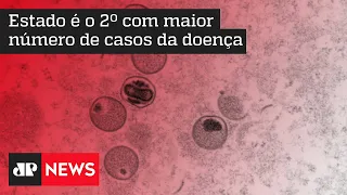 Rio de Janeiro abre novos postos de testagem para varíola dos macacos