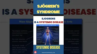 Sjogrens a Systemic Disease - signs and symptoms #sjogren #sjogrens #autoimmunedisease