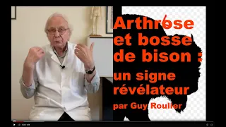 Vidéo Arthrose et bosse de bison : un signe révélateur par Guy Roulier