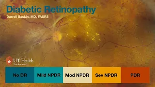 Diabetes and the Retina 2024