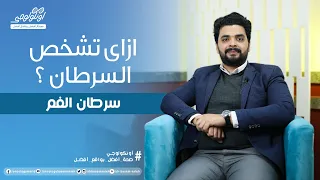 ازاي تشخص سرطان الفم ( أعراض سرطان الفم ) S03 Ep25