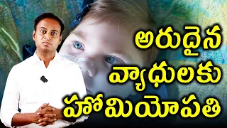 అరుదైన వ్యాధులకు హోమియోపతి . | Dr. Bharadwaz | Homeopathy, Medicine & Surgery