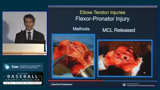 Flexor Pronator Strain, Epicondylitis, and Avulsion