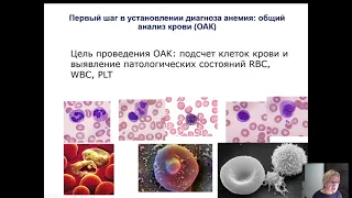 Анемия, общие сведения, дефицитные анемии