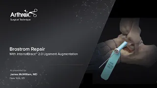 Brostrom Repair With InternalBrace™ 2.0 Ligament Augmentation