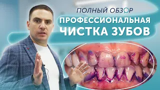 Профессиональная чистка зубов. Обзор процедуры
