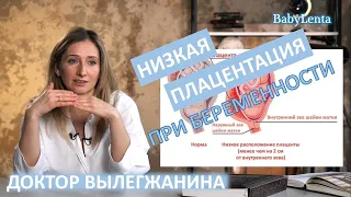 Низкая плацентация при беременности - что это такое, причины, опасность, что делать!