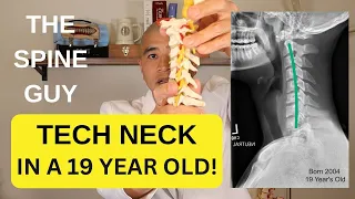 Maintain your cervical spine to prevent neck surgery!