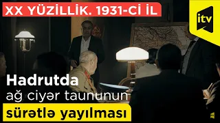 Hadrutda ağ ciyər taununun sürətlə yayılması - “XX yüzillik. 1931-ci il”