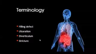 Imaging of the esophagus   DRE 4   Dr Mamdouh Mahfouz 720p